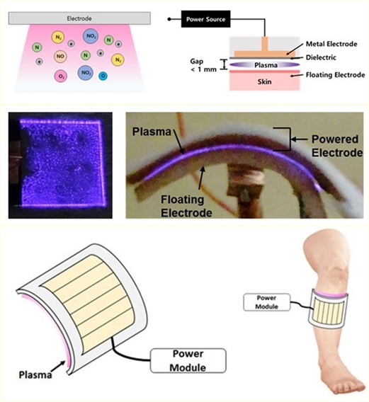 유연전극 플라즈마 시스템 일부 모듈 개발 성공 - 산업종합저널 전자