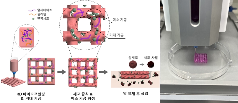 3D 바이오프린팅 기술 세계 최초 개발 - 산업종합저널 기계