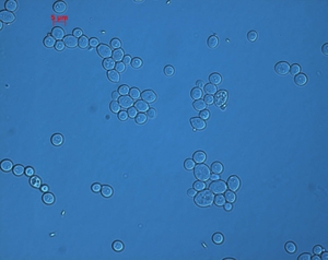 유류 토양오염의 생물학적 정화 길 열려