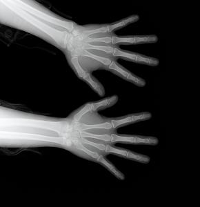 삼성전자, 방사선 의료기기부품 양산 