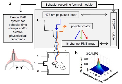 파킨슨병 등 뇌신경질환 연구 기존 학설 뒤집어