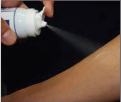 상처에 밴드 대신 스프레이… 기업 특허 지원 성과