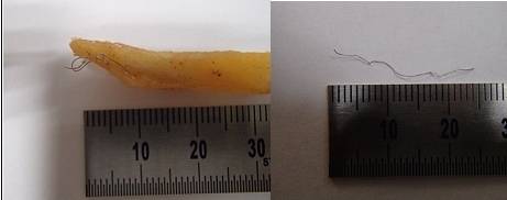 금속 혼입, ‘과자류’ 제품 회수 조치