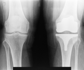 [TECH & INSIDE] 세코툴스, 임플란트 소재로 부상 중인 세라믹의 가공