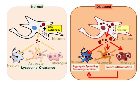 파킨슨병 진행 새로운 이론 제시