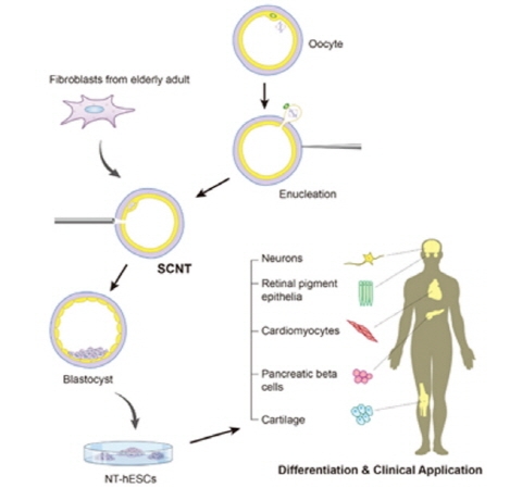 세계 최초 성인 체세포 이용한 체세포복제줄기세포주 확립