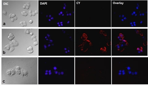 암세포에만 결합하는 나노신소재 개발