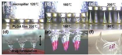 혈관 외벽 장착 위한 약물전달장치 개발