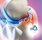 ‘퇴행성관절염 발병 규명’ 치료법 개발 실마리