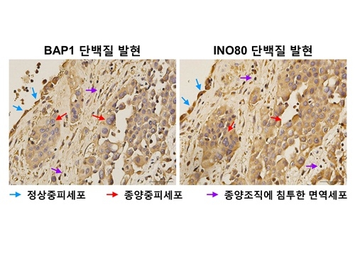 [TECH NEWS] 폐암 발생 억제하는 유전체 지킴이 단백질 발견