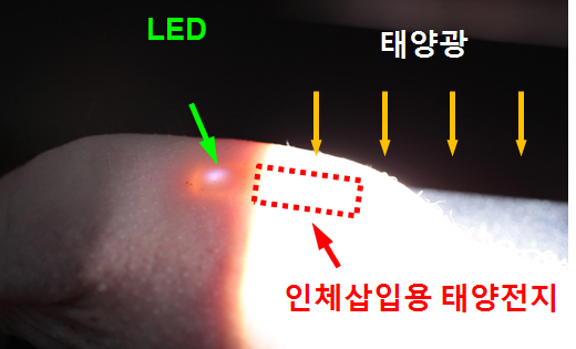 의료기기 전력부족, 피부 삽입 태양전지로 해결
