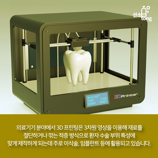 [카드뉴스] 의료기기와 3D 프린터