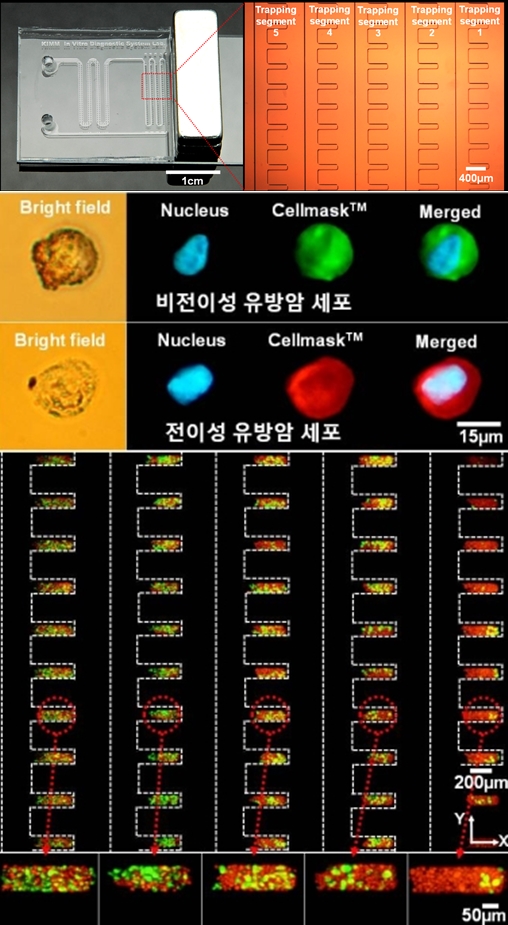 나노 크기 자성물질, 유방암 전이 세포 95% 잡아내