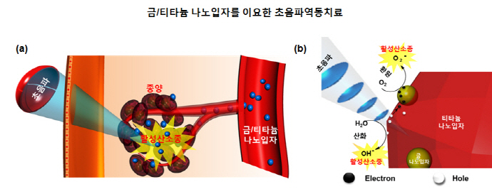 스마트 나노로봇, 초음파 원격제어로 종양 제거