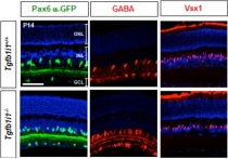 야간이나 어두운 곳에서 명암 인식하는 망막신경세포 발견