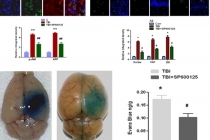 외상성 치매 발병 원인물질 찾았다