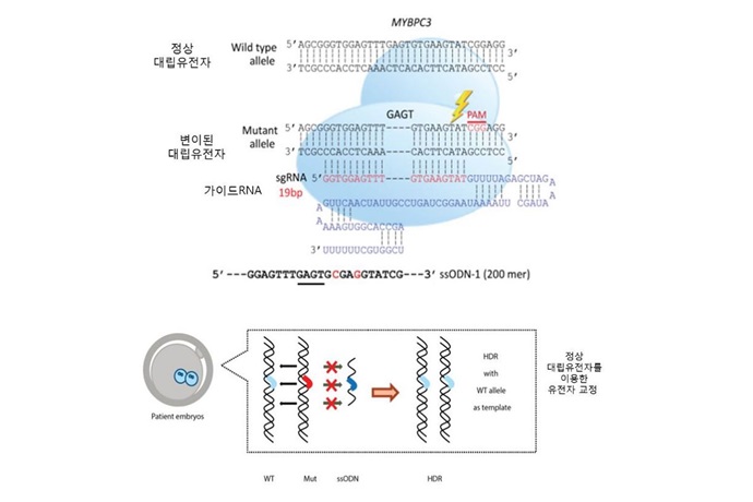 질병 물려받는 세대 종말 보인다…비후성 심근증 등 유전병 예방 새로운 길 열려