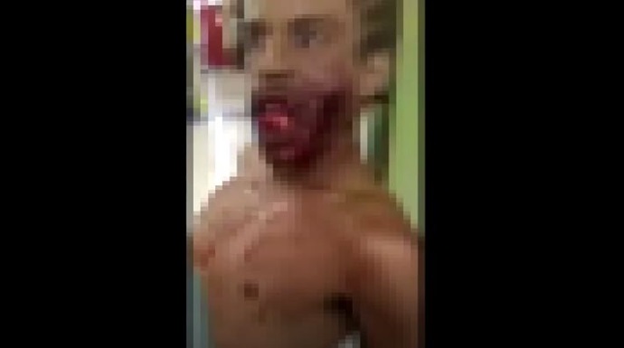 좀비마약 투약 후 좀비되는 과정 영상 유행처럼 번져…환각효과 코카인 ‘10배’