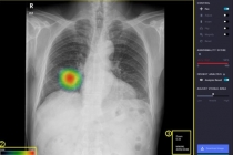 국내 개발 인공지능(AI) 기반 의료기기 허가