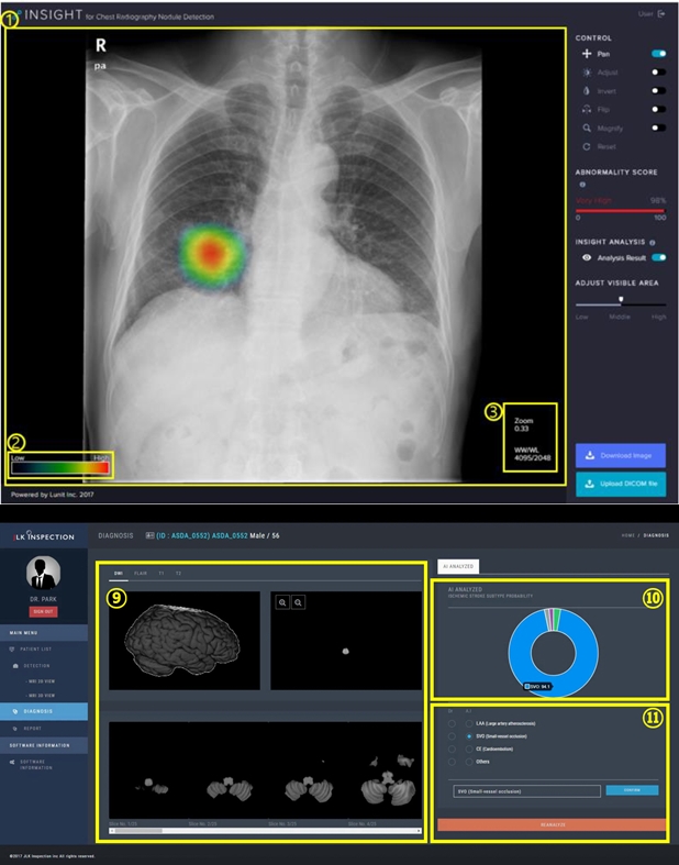 국내 개발 인공지능(AI) 기반 의료기기 허가