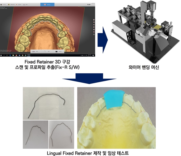 ‘치열 유지용 와이어 자동화 밴딩 시스템’ 기술 개발