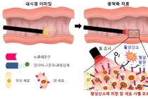소재만 바꿨는데 내시경 암 진단·치료 효과 상승