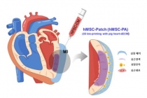 심근경색, 복합 줄기세포 이용한 치료방법 찾아냈다