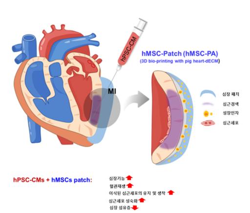 심근경색, 복합 줄기세포 이용한 치료방법 찾아냈다