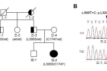 파킨슨병 발병·진행 조절 가능성 열려