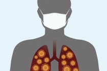 신종 코로나바이러스 감염병 ‘주의’에서 ‘경계’ 격상