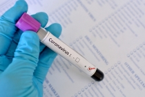 신종 코로나바이러스 진단 6시간 이내 결과 확인