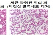 감염 악화시키는 ‘고장난 면역세포’ 존재 규명