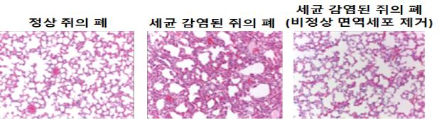 감염 악화시키는 ‘고장난 면역세포’ 존재 규명
