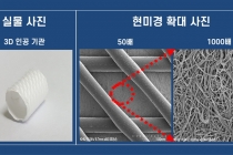 기관협착, 3D 튜브형 인공 기관으로 방지한다