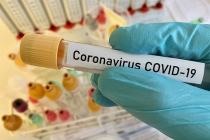 중국 경제 의존도 높은 호주, 코로나19 영향 제조 및 교육산업, 관광업 피해 ‘심각’