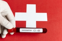 스위스, 코로나 팬데믹에 금융위기 때처럼 선제 대응 보일까