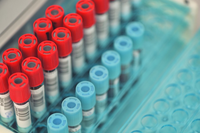 코로나19에 신속·투명한 韓대응, ‘독일 체외진단 기기 시장’ 문 열었다