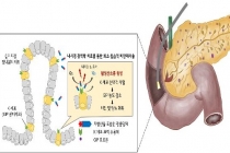 광(光)역학 치료로 비만 등 대사성 질환 치료 박차