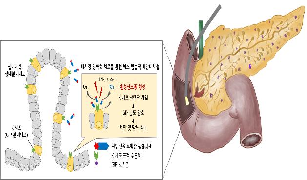 광(光)역학 치료로 비만 등 대사성 질환 치료 박차
