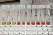 바이러스(코로나19 바이러스 포함)진단 검사용 품질분량 검체 회수조치