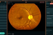 첨단기술 적용한 ‘혁신의료기기’ 최초 지정, 제품화 지원 본격화