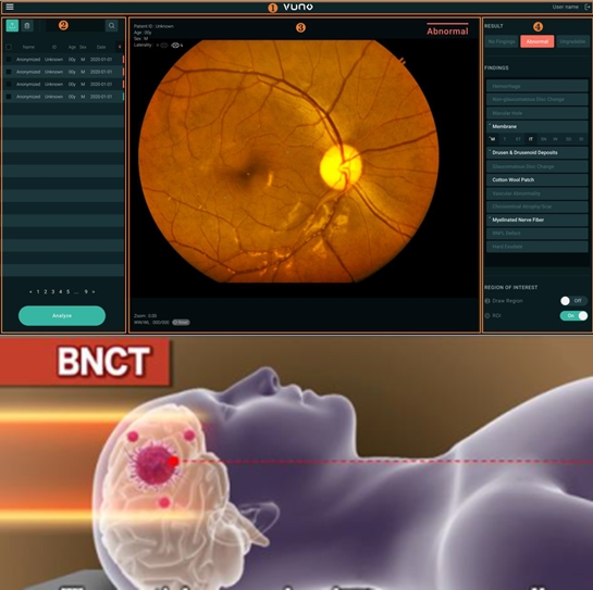 첨단기술 적용한 ‘혁신의료기기’ 최초 지정, 제품화 지원 본격화