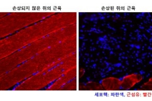 근섬유다발, 3D프린팅 넘어 4D 프린팅으로 만들어낸다