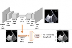 영상의료진단 장비, 빅데이터 활용한 딥러닝으로 한층 더 스마트해진다
